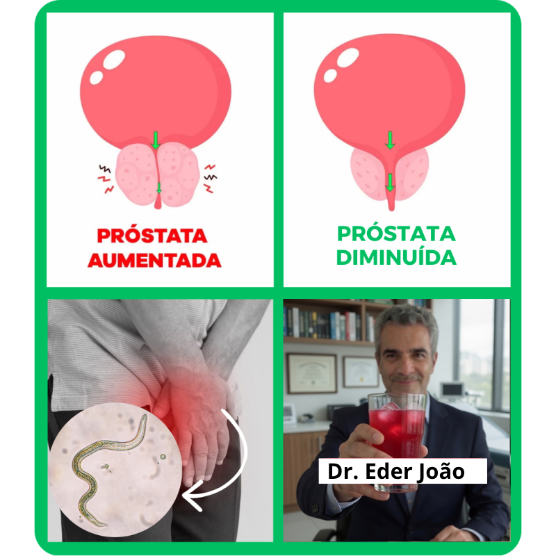 Comparativo de próstata aumentada e diminuída com receita natural